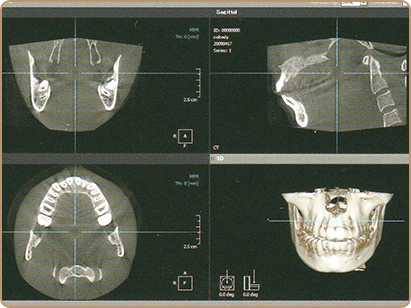 最新の歯科用CT画像