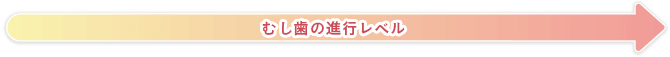 むし歯の進行レベル