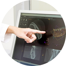 1.歯科用CTによる精密な診断
