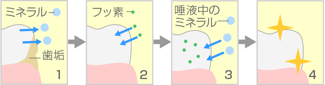 フッ素塗布